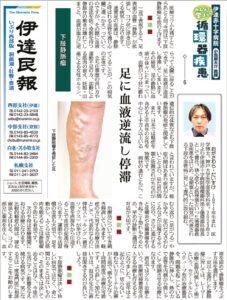varicose veinsのサムネイル